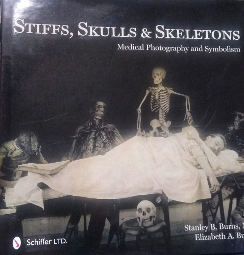 Book cover depicting a sleeping man on a cooling board being attended to by cadavers and a skeleton. 
Book title Stiffs, Skulls & Skeletons: Medical Photography and Symbolism. 